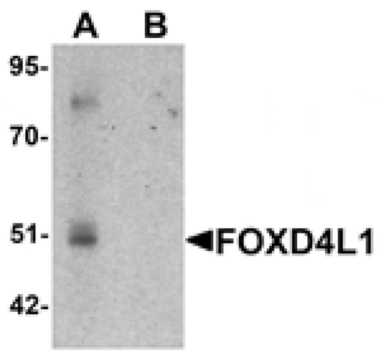 Western blot - FOXD4L1 Antibody from Signalway Antibody (25420) - Antibodies.com