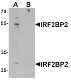 Western blot - IRF2BP2 Antibody from Signalway Antibody (25421) - Antibodies.com