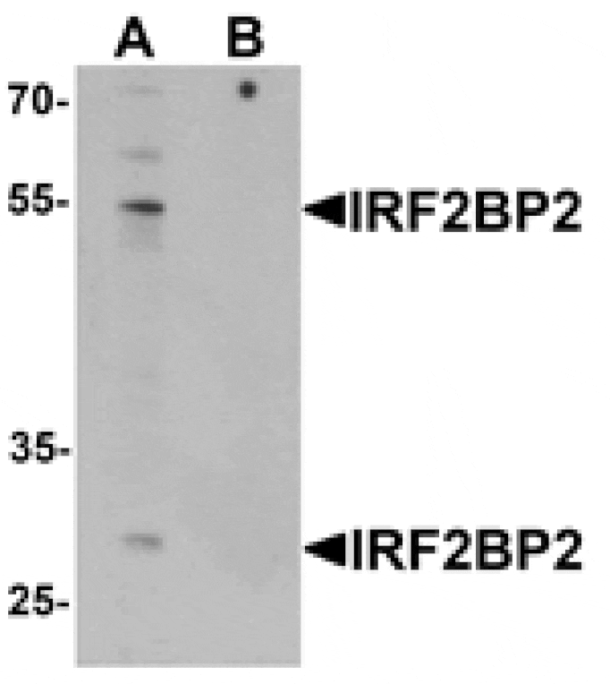Western blot - IRF2BP2 Antibody from Signalway Antibody (25421) - Antibodies.com