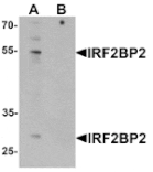 Western blot - IRF2BP2 Antibody from Signalway Antibody (25421) - Antibodies.com