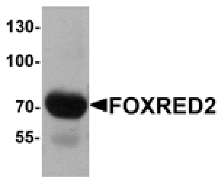 Western blot - FOXRED2 Antibody from Signalway Antibody (25460) - Antibodies.com