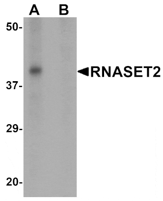 Western blot - RNASET2 Antibody from Signalway Antibody (25461) - Antibodies.com