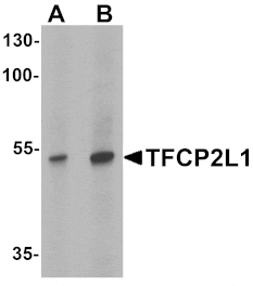 Western blot - TFCP2L1 Antibody from Signalway Antibody (25477) - Antibodies.com