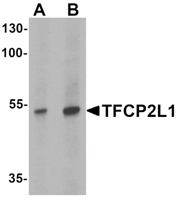 Western blot - TFCP2L1 Antibody from Signalway Antibody (25477) - Antibodies.com