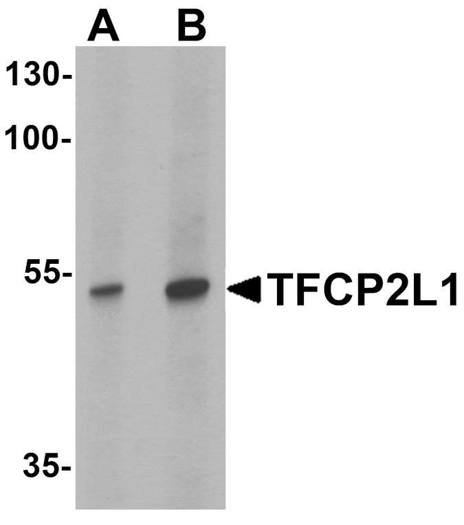 Western blot - TFCP2L1 Antibody from Signalway Antibody (25477) - Antibodies.com