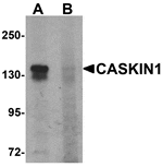Western blot analysis of CASKIN1 in HeLa cell lysate with CASKIN1 antibody at 1 µg/mL in (A) the absence and (B) the presence of blocking peptide.