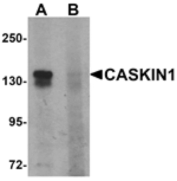 Western blot - CASKIN1 Antibody from Signalway Antibody (25525) - Antibodies.com