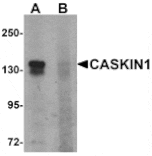 Western blot - CASKIN1 Antibody from Signalway Antibody (25525) - Antibodies.com
