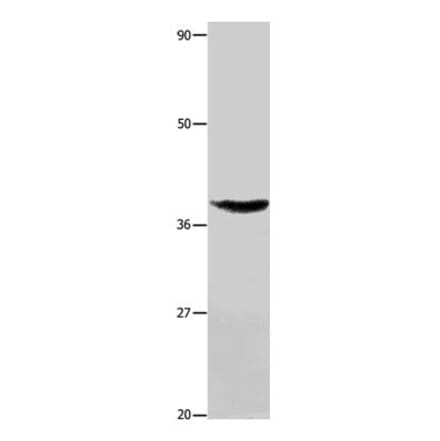 TNFRSF6 Antibody from Signalway Antibody (31015) - Antibodies.com
