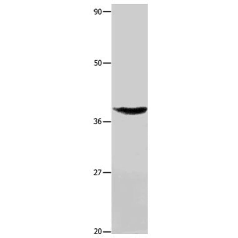 TNFRSF6 Antibody from Signalway Antibody (31015) - Antibodies.com