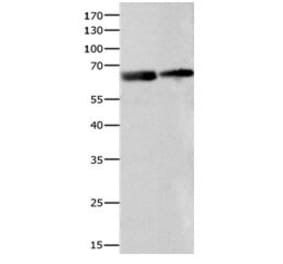 IGF2BP2 Antibody from Signalway Antibody (31088) - Antibodies.com