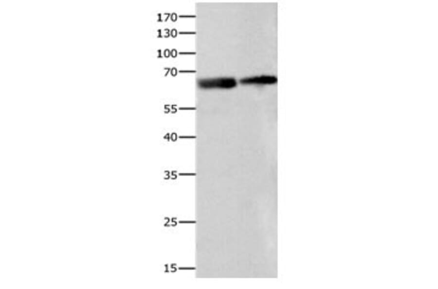 IGF2BP2 Antibody from Signalway Antibody (31088) - Antibodies.com