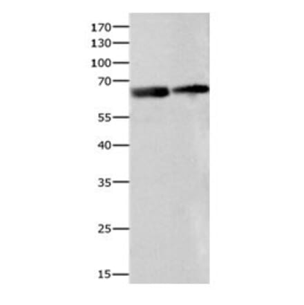 IGF2BP2 Antibody from Signalway Antibody (31088) - Antibodies.com