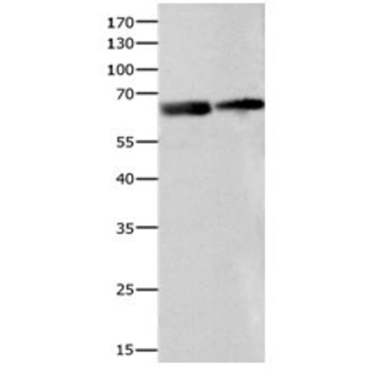 IGF2BP2 Antibody from Signalway Antibody (31088) - Antibodies.com