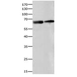 IGF2BP2 Antibody from Signalway Antibody (31088) - Antibodies.com