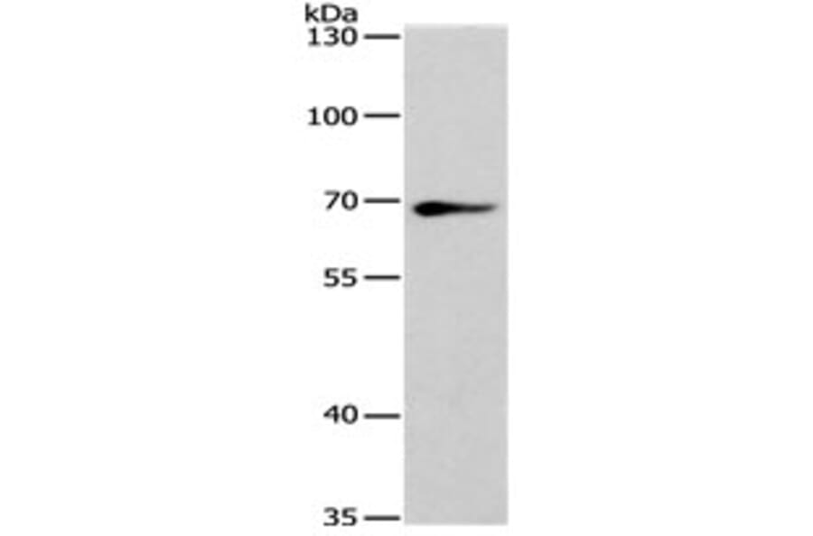 SPATA13 Antibody from Signalway Antibody (31130) - Antibodies.com