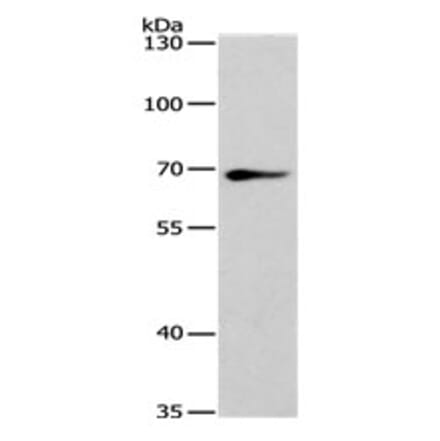 SPATA13 Antibody from Signalway Antibody (31130) - Antibodies.com