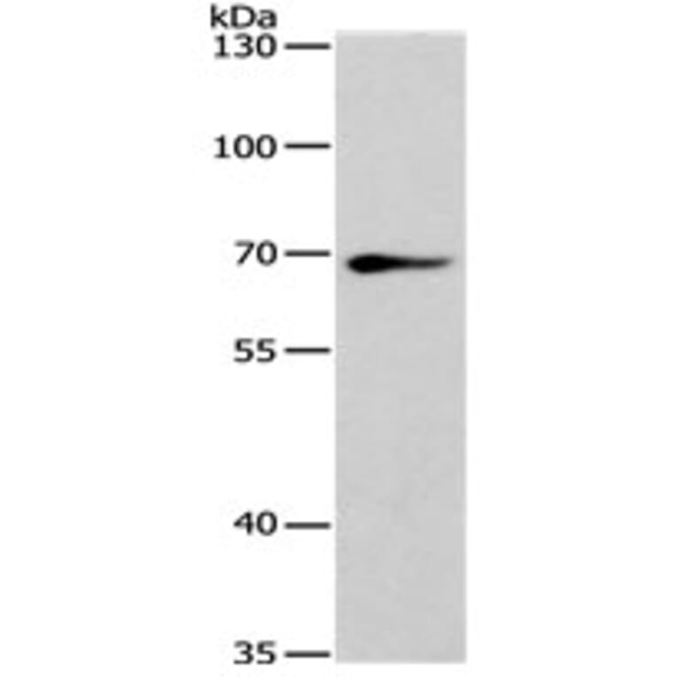 SPATA13 Antibody from Signalway Antibody (31130) - Antibodies.com