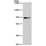 SPATA13 Antibody from Signalway Antibody (31130) - Antibodies.com