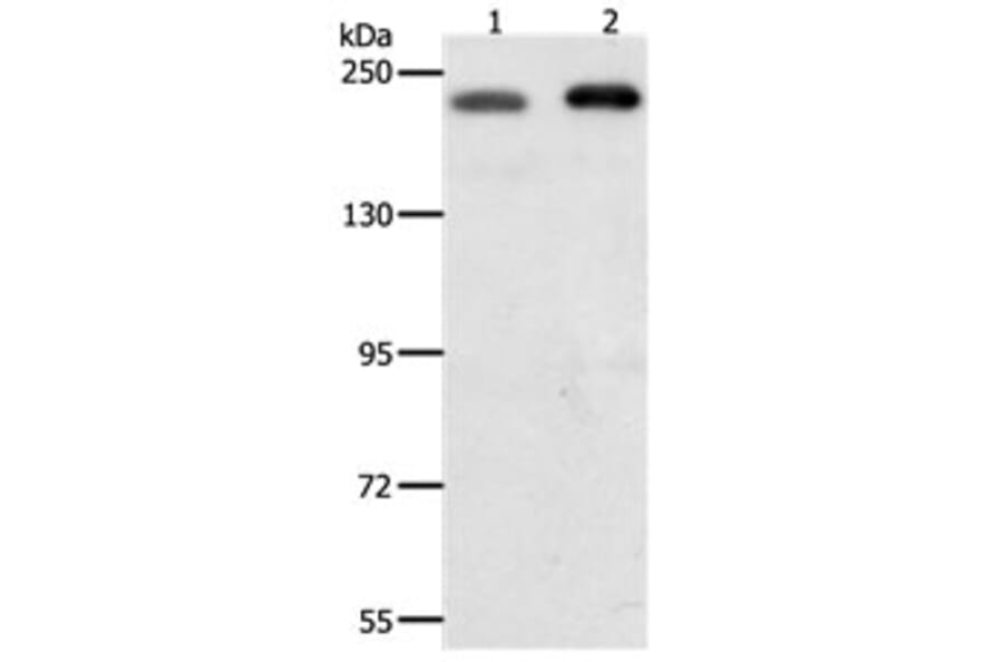 SMARCA4 Antibody from Signalway Antibody (31163) - Antibodies.com
