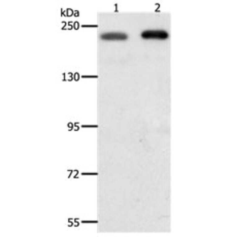 SMARCA4 Antibody from Signalway Antibody (31163) - Antibodies.com