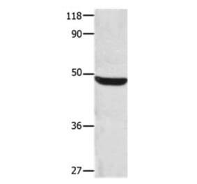 CSNK1A1 Antibody from Signalway Antibody (31170) - Antibodies.com