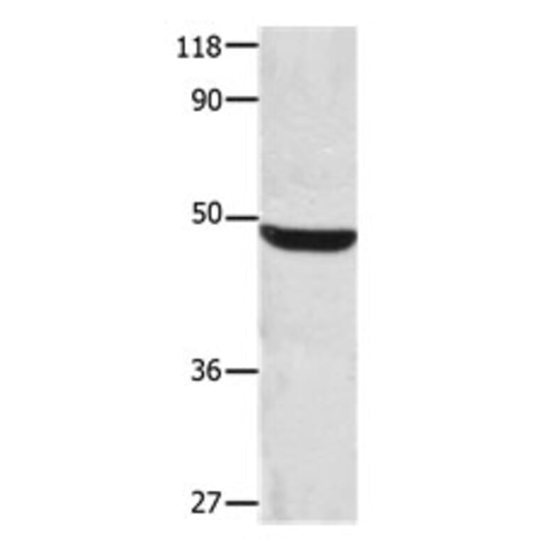 CSNK1A1 Antibody from Signalway Antibody (31170) - Antibodies.com