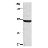 CSNK1A1 Antibody from Signalway Antibody (31170) - Antibodies.com