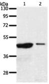 Gel: 10% SDS-PAGE Lane1: 231 cell lysate Lane2: A549 cell lysate. Lysates: 40 µg per lane. Primary antibody: 1/100 dilution. Secondary antibody: Goat anti Rabbit IgG - H&L (HRP) at 1/10000 dilution. Exposure time: 30 minutes