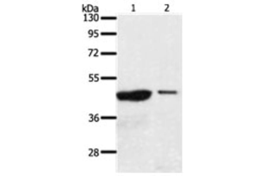 AADACL4 Antibody from Signalway Antibody (31298) - Antibodies.com