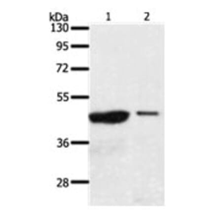 AADACL4 Antibody from Signalway Antibody (31298) - Antibodies.com