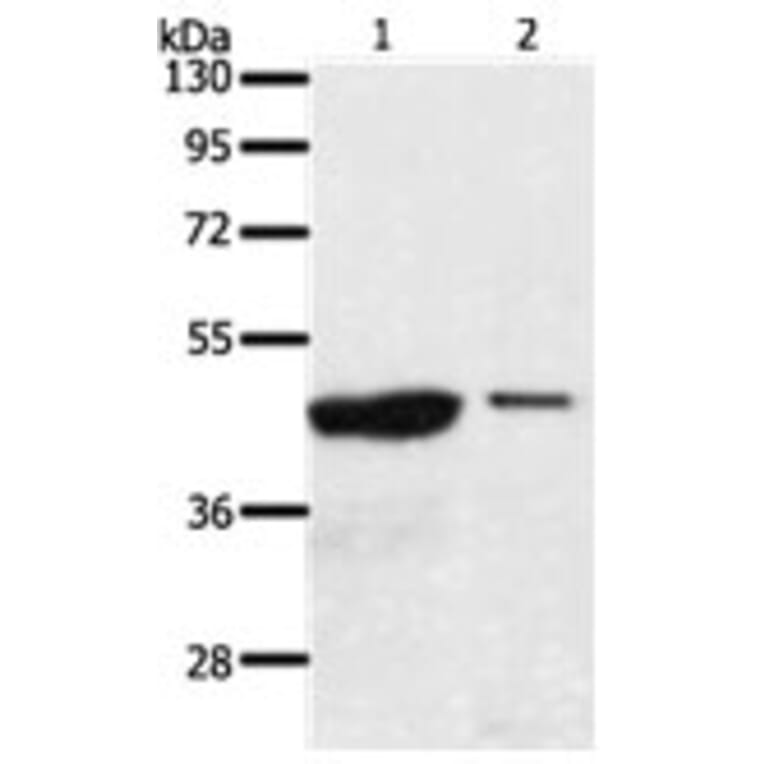 AADACL4 Antibody from Signalway Antibody (31298) - Antibodies.com