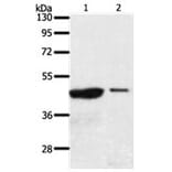 AADACL4 Antibody from Signalway Antibody (31298) - Antibodies.com