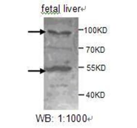 ADAMTS8 Antibody from Signalway Antibody (39207) - Antibodies.com