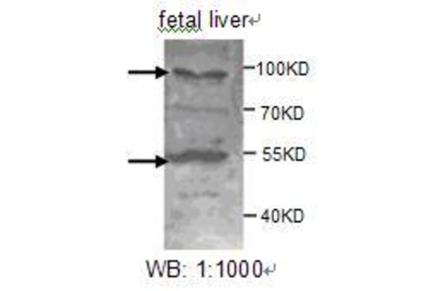 ADAMTS8 Antibody from Signalway Antibody (39207) - Antibodies.com
