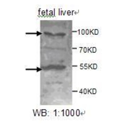 ADAMTS8 Antibody from Signalway Antibody (39207) - Antibodies.com