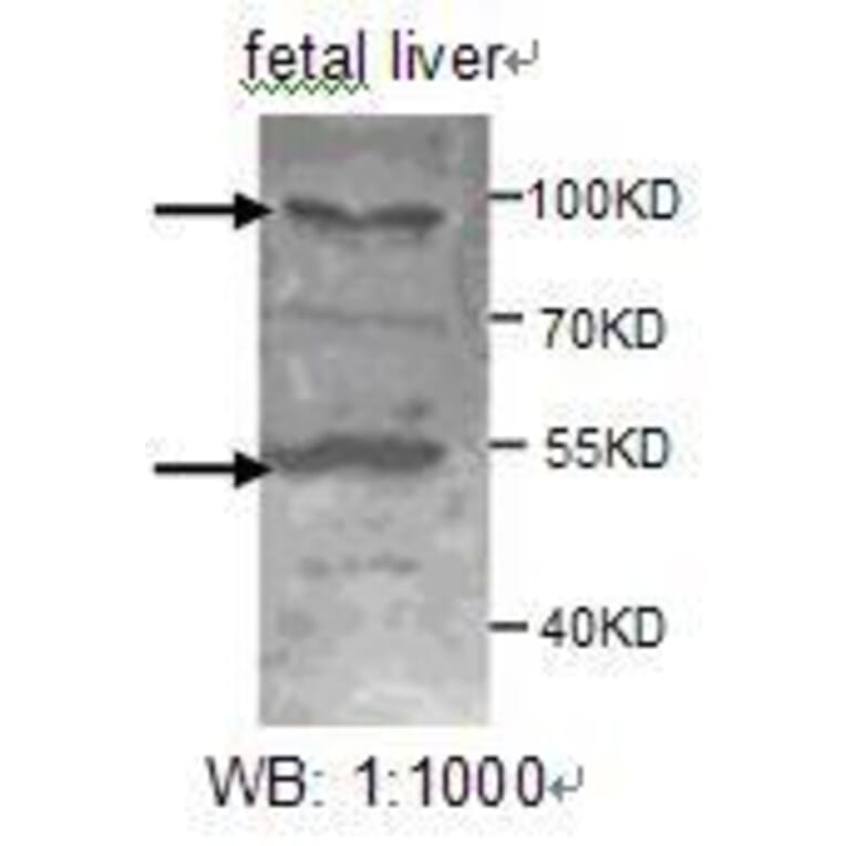 ADAMTS8 Antibody from Signalway Antibody (39207) - Antibodies.com