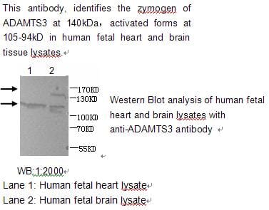 Anti-ADAMTS3 Antibody