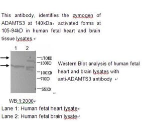 ADAMTS3 Antibody from Signalway Antibody (39211) - Antibodies.com