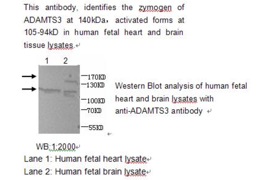 ADAMTS3 Antibody from Signalway Antibody (39211) - Antibodies.com