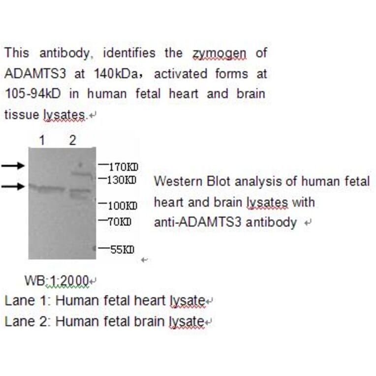 ADAMTS3 Antibody from Signalway Antibody (39211) - Antibodies.com
