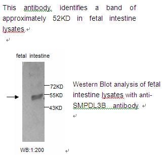 Anti-SMPDL3B Antibody