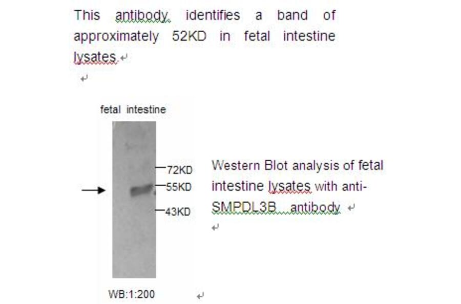 SMPDL3B Antibody from Signalway Antibody (39223) - Antibodies.com