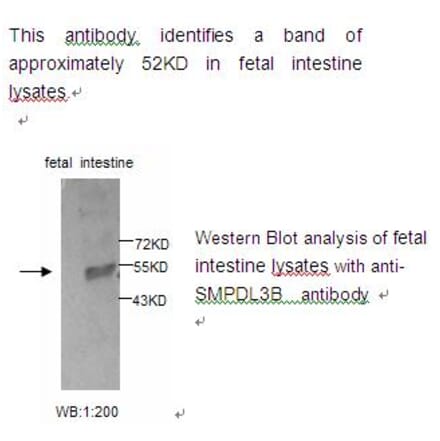 SMPDL3B Antibody from Signalway Antibody (39223) - Antibodies.com