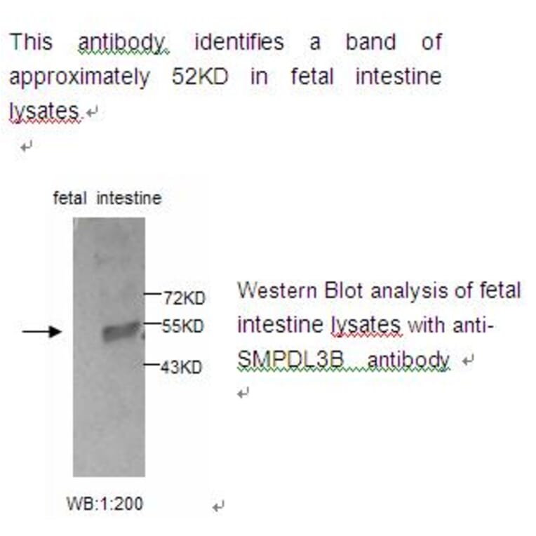 SMPDL3B Antibody from Signalway Antibody (39223) - Antibodies.com