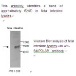 SMPDL3B Antibody from Signalway Antibody (39223) - Antibodies.com