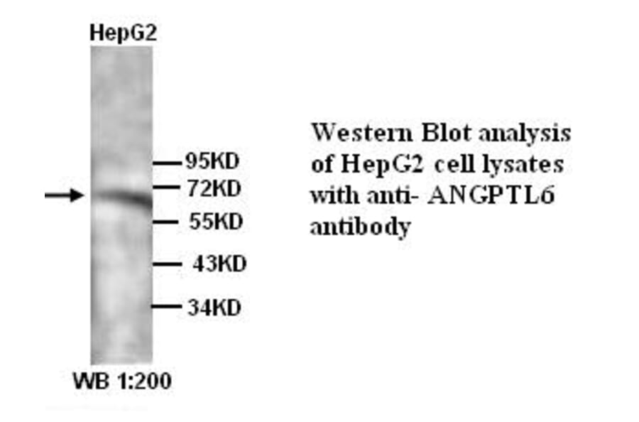 ANGPTL6 Antibody from Signalway Antibody (39318) - Antibodies.com