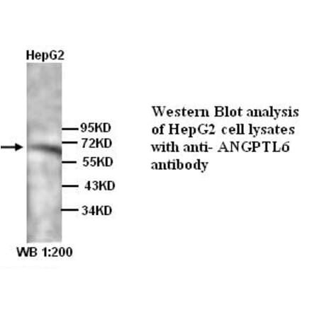 ANGPTL6 Antibody from Signalway Antibody (39318) - Antibodies.com