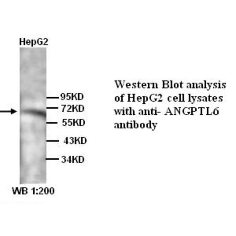 ANGPTL6 Antibody from Signalway Antibody (39318) - Antibodies.com