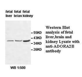 ADORA2B Antibody from Signalway Antibody (39513) - Antibodies.com